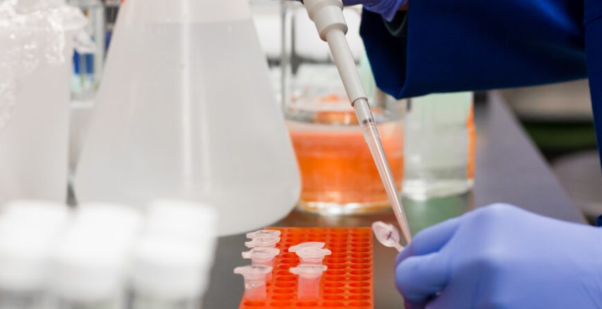 diagnostico-de-covid-19-la-pcr-sera-similar-a-la-prueba-del-embarazo
